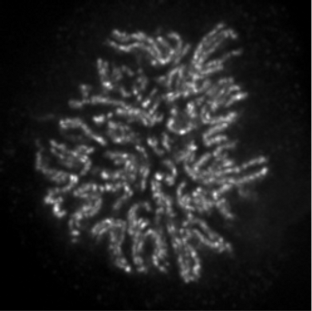 Anti Condensin-2 Complex Subunit H2 (CAP-H2) mAb (Clone 5F2G4)