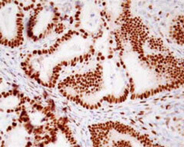 Anti Progesterone Receptor (PGR) common mAb (Clone A9621A)