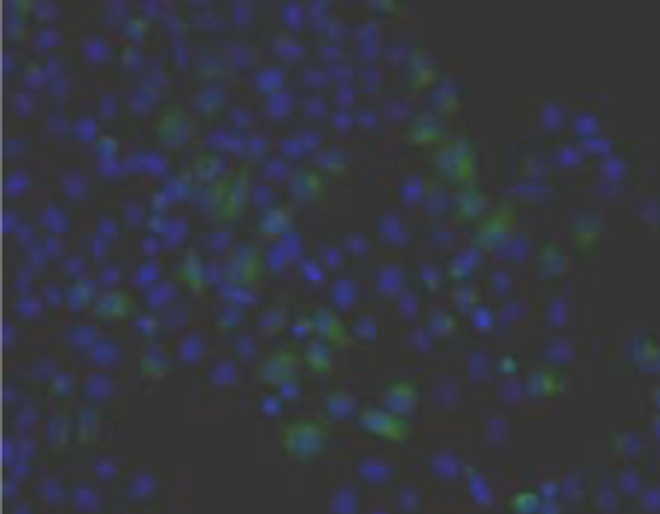 Anti Human/Rat/Mouse Transmembrane Glycoprotein NMB (GPNMB) pAb (Rabbit, Purified Ig)