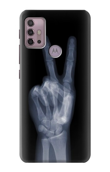 S3101 X-ray doigts Signe de paix Etui Coque Housse pour Motorola Moto G30, G20, G10