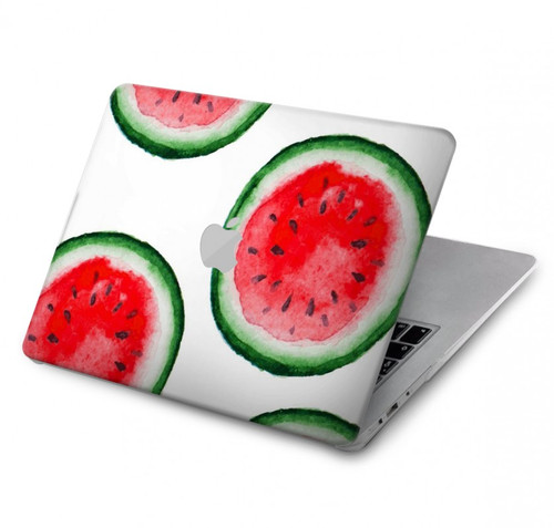 S3236 Motif melon d'eau Etui Coque Housse pour MacBook 12″ - A1534