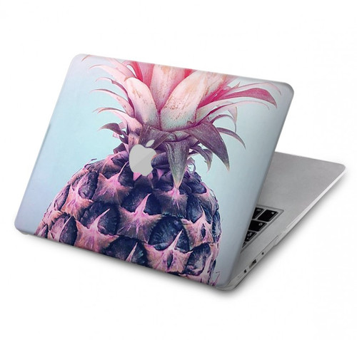 S3711 Ananas rose Etui Coque Housse pour MacBook Pro 13″ - A1706, A1708, A1989, A2159, A2289, A2251, A2338