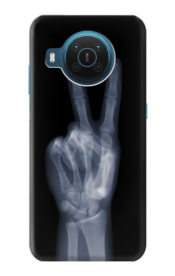 S3101 X-ray doigts Signe de paix Etui Coque Housse pour Nokia X20