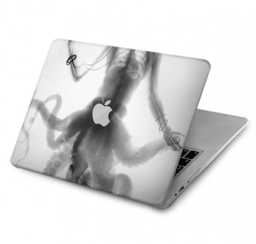 S1432 Crâne Poulpe X-ray Etui Coque Housse pour MacBook Pro 14 M1-M5 A2442,A2779,A2992,A2918,A3112,A3185,A3401,A3434,A3112