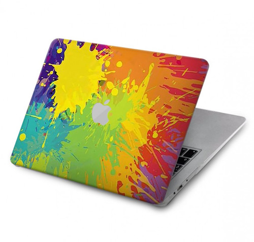 S3675 Tâche de couleur Etui Coque Housse pour MacBook Pro 14 M1,M2,M3 (2021,2023) - A2442, A2779, A2992, A2918