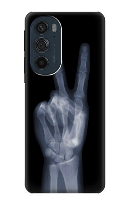 S3101 X-ray doigts Signe de paix Etui Coque Housse pour Motorola Edge 30 Pro