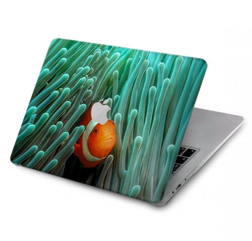 S3893 Poisson-clown Ocellaris Etui Coque Housse pour MacBook Pro Retina 13″ - A1425, A1502