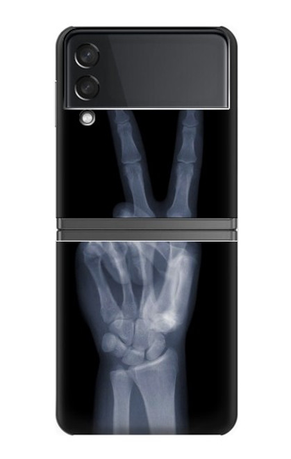 S3101 X-ray doigts Signe de paix Etui Coque Housse pour Samsung Galaxy Z Flip 4