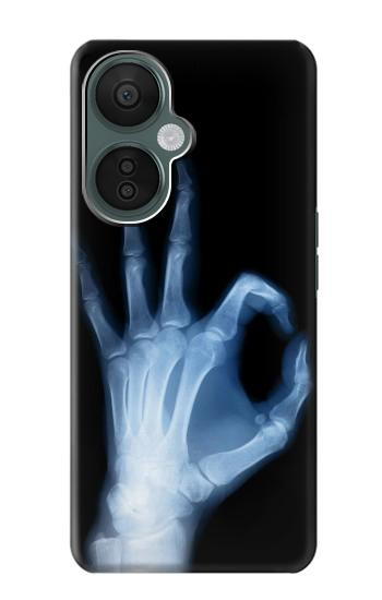 S3239 X-Ray Geste de la main OK Etui Coque Housse pour OnePlus Nord CE 3 Lite, Nord N30 5G
