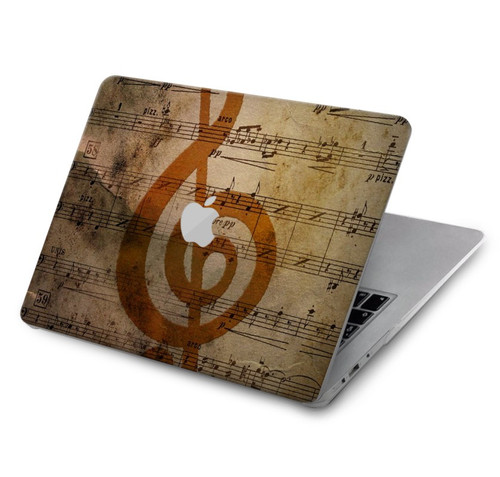 S2368 Note de musique Etui Coque Housse pour MacBook Air 15″ (2023,2024,2025) - A2941, A3114, A3241