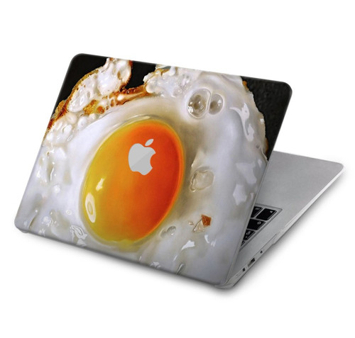 S2695 Oeuf frit Etui Coque Housse pour MacBook Air 15″ (2023,2024,2025) - A2941, A3114, A3241 S2695 Oeuf frit Etui Coque Housse pour MacBook Air 15″ (2023,2024,2025) - A2941, A3114, A3241