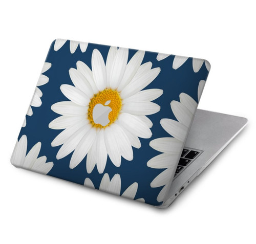 S3009 Daisy bleu Etui Coque Housse pour MacBook Air 15″ (2023,2024) - A2941, A3114