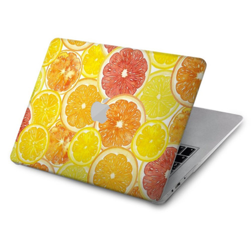 S3408 citron Etui Coque Housse pour MacBook Air 15″ (2023,2024,2025) - A2941, A3114, A3241