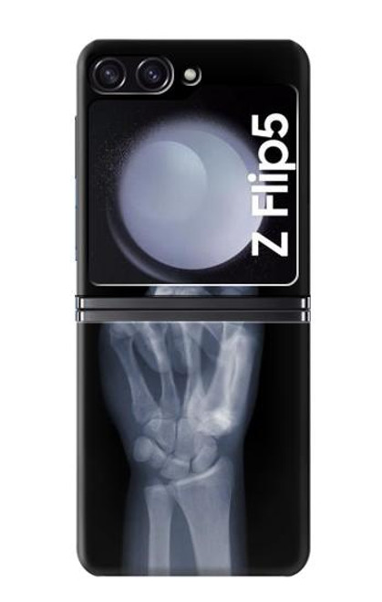 S3101 X-ray doigts Signe de paix Etui Coque Housse pour Samsung Galaxy Z Flip 5