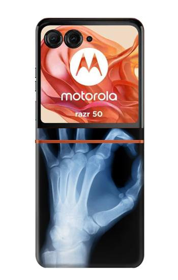 S3239 X-Ray Geste de la main OK Etui Coque Housse pour Motorola Razr 70,60,50, Razr (2026, 2025, 2024)