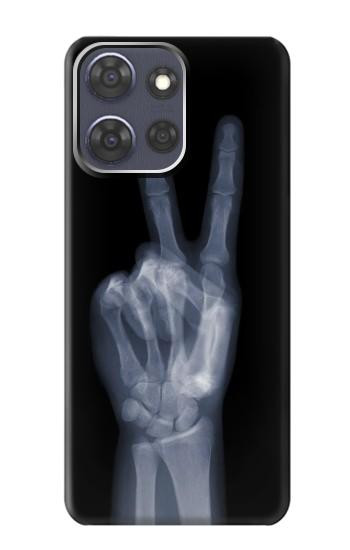 S3101 X-ray doigts Signe de paix Etui Coque Housse pour Motorola Moto G Power (2025,2026)
