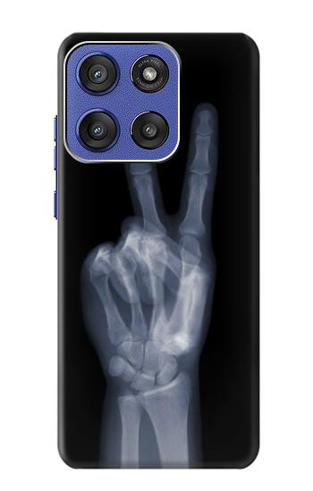 S3101 X-ray doigts Signe de paix Etui Coque Housse pour Motorola Moto G Stylus 5G (2025,2026), Edge 60 Stylus