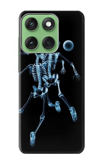 S1111 Football X-ray Etui Coque Housse pour Motorola Edge 60