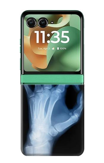 S3239 X-Ray Geste de la main OK Etui Coque Housse pour Motorola Razr 70+,60+, Razr+ (2026, 2025, 2024)