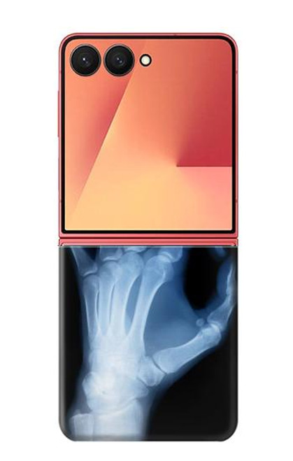 S3239 X-Ray Geste de la main OK Etui Coque Housse pour Samsung Galaxy Z Flip 7