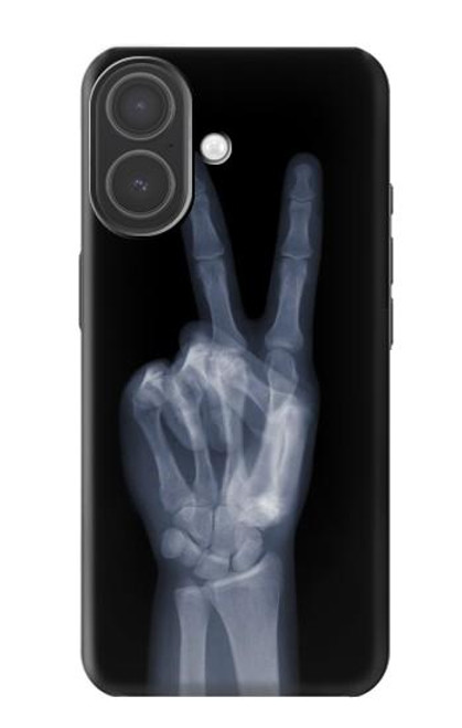 S3101 X-ray doigts Signe de paix Etui Coque Housse pour iPhone 17
