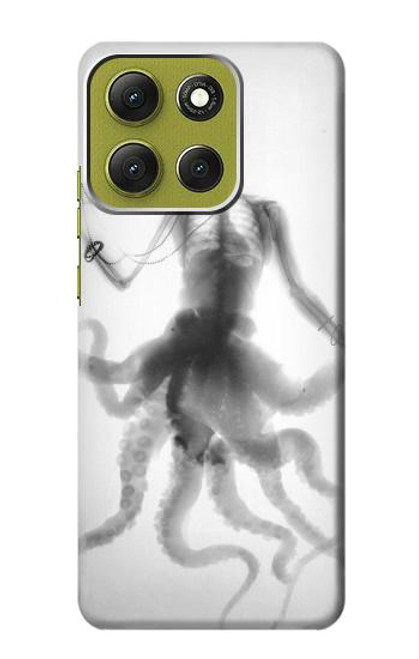 S1432 Crâne Poulpe X-ray Etui Coque Housse pour Motorola Moto G86 S1432 Crâne Poulpe X-ray Etui Coque Housse pour Motorola Moto G86