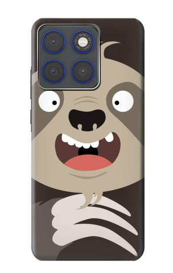 S3855 Dessin animé visage paresseux Etui Coque Housse pour Motorola Edge 70