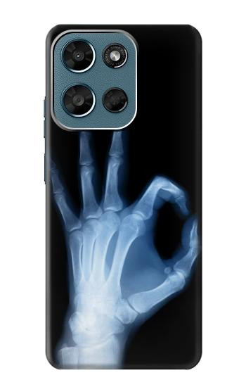S3239 X-Ray Geste de la main OK Etui Coque Housse pour Motorola Moto G (2026), G Play (2026)
