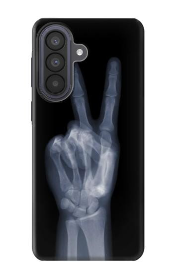 S3101 X-ray doigts Signe de paix Etui Coque Housse pour Samsung Galaxy A57