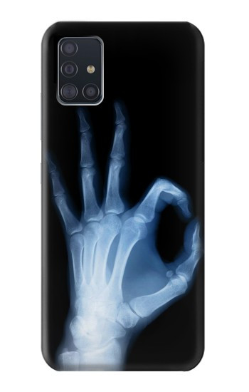 S3239 X-Ray Geste de la main OK Etui Coque Housse pour Samsung Galaxy A51 5G