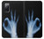 S3239 X-Ray Geste de la main OK Etui Coque Housse pour Samsung Galaxy S20 FE