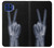S3101 X-ray doigts Signe de paix Etui Coque Housse pour Motorola One 5G