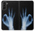 S3239 X-Ray Geste de la main OK Etui Coque Housse pour Samsung Galaxy S21 Plus 5G, Galaxy S21+ 5G