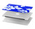 S2244 Motif Hawai Hibiscus Bleu Etui Coque Housse pour MacBook 12″ - A1534