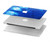 S1869 Tie Dye Bleu Etui Coque Housse pour MacBook Air 13″ - A1369, A1466