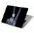S3101 X-ray doigts Signe de paix Etui Coque Housse pour MacBook Air 13″ - A1369, A1466