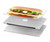 S0790 Hamburger Etui Coque Housse pour MacBook Pro 13″ - A1706, A1708, A1989, A2159, A2289, A2251, A2338