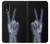S3101 X-ray doigts Signe de paix Etui Coque Housse pour Samsung Galaxy Xcover 5