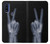 S3101 X-ray doigts Signe de paix Etui Coque Housse pour Motorola G Pure