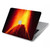 S0745 Volcan Lave Etui Coque Housse pour MacBook Pro 14 M1,M2,M3 (2021,2023) - A2442, A2779, A2992, A2918