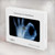 S3239 X-Ray Geste de la main OK Etui Coque Housse pour MacBook Pro 14 M1-M5 A2442,A2779,A2992,A2918,A3112,A3185,A3401,A3434,A3112