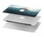 S3540 géant Poulpe Etui Coque Housse pour MacBook Pro 14 M1,M2,M3 (2021,2023) - A2442, A2779, A2992, A2918