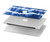 S3671 Tie Dye bleu Etui Coque Housse pour MacBook Pro 14 M1,M2,M3 (2021,2023) - A2442, A2779, A2992, A2918