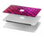 S3051 Rose Sirène écailles de poisson Etui Coque Housse pour MacBook Pro 16 M1,M2 (2021,2023) - A2485, A2780