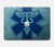 S3824 Symbole Médical Caducée Etui Coque Housse pour MacBook Pro 16 M1,M2,M3,M4 (2021,2024) - A3403, A3186, A2991, A2780, A2485