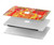 S3352 Gustav Klimt Médecine Etui Coque Housse pour MacBook Air 13″ (2022,2024) - A2681, A3113