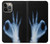 S3239 X-Ray Geste de la main OK Etui Coque Housse pour iPhone 14 Pro