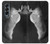 S1593 Chausson de danse Pointe Etui Coque Housse pour Samsung Galaxy Z Fold 4