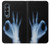 S3239 X-Ray Geste de la main OK Etui Coque Housse pour Samsung Galaxy Z Fold 4
