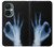S3239 X-Ray Geste de la main OK Etui Coque Housse pour OnePlus Nord CE 3 Lite, Nord N30 5G
